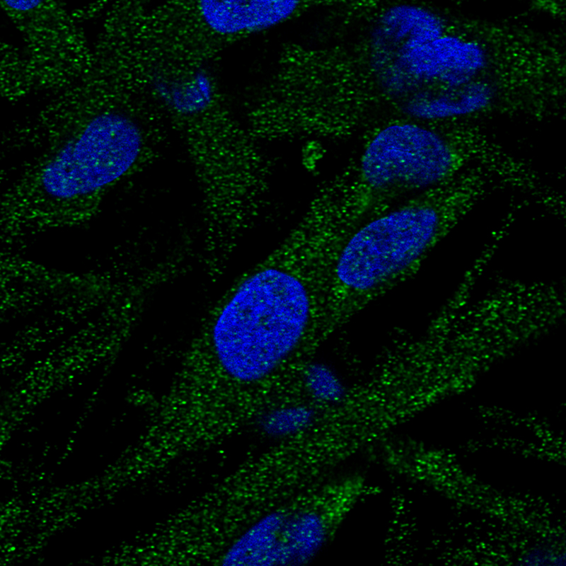 Anti-EPG5 Antibody