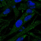 Anti-EPG5 Antibody