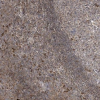 Anti-MB21D1 Antibody