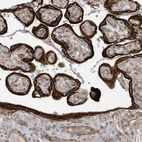 Immunohistochemical staining of human placenta shows strong cytoplasmic positivity in trophoblastic cells.
