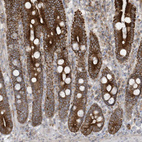 Immunohistochemical staining of human upper gastrointestinal shows strong cytoplasmic positivity in glandular cells.