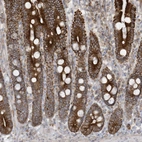 Immunohistochemical staining of human upper gastrointestinal shows strong cytoplasmic positivity in glandular cells.