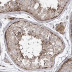Immunohistochemical staining of human testis shows moderate cytoplasmic positivity in cells in seminiferous ducts.