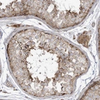 Immunohistochemical staining of human testis shows moderate cytoplasmic positivity in cells in seminiferous ducts.