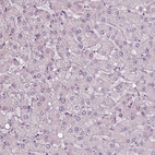 Immunohistochemical staining of human liver shows no positivity in hepatocytes as expected.