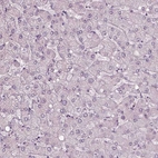 Immunohistochemical staining of human liver shows no positivity in hepatocytes as expected.