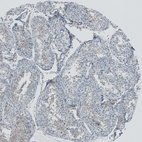 Immunohistochemical staining of human testis shows weak cytoplasmic positivity in cells in seminiferous ducts.