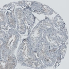 Immunohistochemical staining of human testis shows weak cytoplasmic positivity in cells in seminiferous ducts.