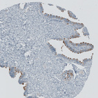 Immunohistochemical staining of human Fallopian tube shows strong cilia positivity in glandular cells.