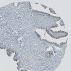 Immunohistochemical staining of human Fallopian tube shows strong cilia positivity in glandular cells.
