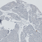 Immunohistochemical staining of human pancreas shows no positivity in exocrine glandular cells as expected.