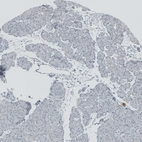 Immunohistochemical staining of human pancreas shows no positivity in exocrine glandular cells as expected.
