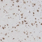 Anti-GPR107 Antibody