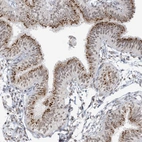 Immunohistochemical staining of human Fallopian tube shows strong positivity in Golgi apparatus in glandular cells.