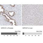 Immunohistochemistry analysis in human prostate and liver tissues using HPA031704 antibody. Corresponding GPR107 RNA-seq data are presented for the same tissues.