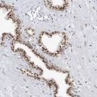 Immunohistochemical staining of human prostate shows strong positivity in Golgi apparatus in glandular cells.