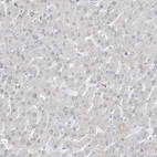 Immunohistochemical staining of human liver shows no positivity in hepatocytes as expected.