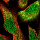 Immunofluorescent staining of human cell line U-2 OS shows localization to nucleoplasm & cytosol.