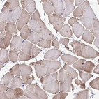 Immunohistochemical staining of human skeletal muscle shows moderate cytoplasmic positivity in myocytes.