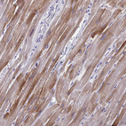 Immunohistochemical staining of human heart muscle shows moderate cytoplasmic positivity in myocytes.