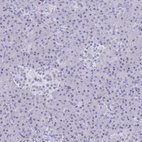 Immunohistochemical staining of human pancreas shows no positivity as expected.