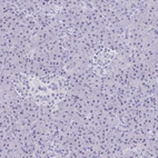Immunohistochemical staining of human pancreas shows no positivity as expected.