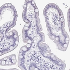 Immunohistochemical staining of human duodenum shows no positivity in glandular cells as expected.