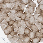 Immunohistochemical staining of human skeletal muscle shows moderate to strong cytoplasmic positivity in myocytes.