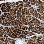 Immunohistochemical staining of human heart muscle shows strong cytoplasmic positivity in myocytes.