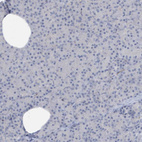 Immunohistochemical staining of human pancreas shows no positivity as expected.