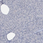 Immunohistochemical staining of human pancreas shows no positivity as expected.