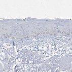 Immunohistochemical staining of human skin shows no positivity in squamous epithelial cells as expected.