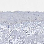 Immunohistochemical staining of human skin shows no positivity in squamous epithelial cells as expected.
