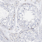 Anti-SPOCD1 Antibody