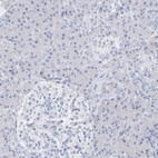 Anti-SPOCD1 Antibody