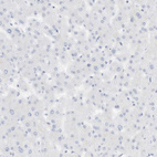 Anti-SPOCD1 Antibody