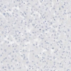 Immunohistochemical staining of human liver shows no positivity in hepatocytes as expected.