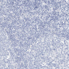 Anti-SPOCD1 Antibody