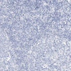 Immunohistochemical staining of human tonsil shows no positivity in non-germinal center cells as expected.