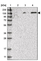 Anti-SPOCD1 Antibody