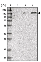 Lane 1: Marker [kDa] 230, 130, 95, 72, 56, 36, 28, 17, 11_br/_Lane 2: Human cell line RT-4_br/_Lane 3: Human cell line U-251MG sp_br/_Lane 4: Human plasma (IgG/HSA depleted)