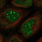 Immunofluorescent staining of human cell line A-431 shows localization to nucleus, nucleoli & cytosol.