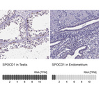 Anti-SPOCD1 Antibody