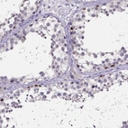 Immunohistochemical staining of human testis shows high expression.