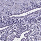 Immunohistochemical staining of human endometrium shows low expression as expected.