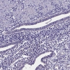 Immunohistochemical staining of human endometrium shows low expression as expected.