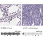 Anti-SPOCD1 Antibody