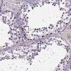 Immunohistochemical staining of human testis shows high expression.
