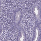 Anti-SPOCD1 Antibody