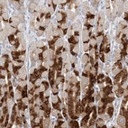 Immunohistochemical staining of human stomach shows strong cytoplasmic positivity in glandular cells.